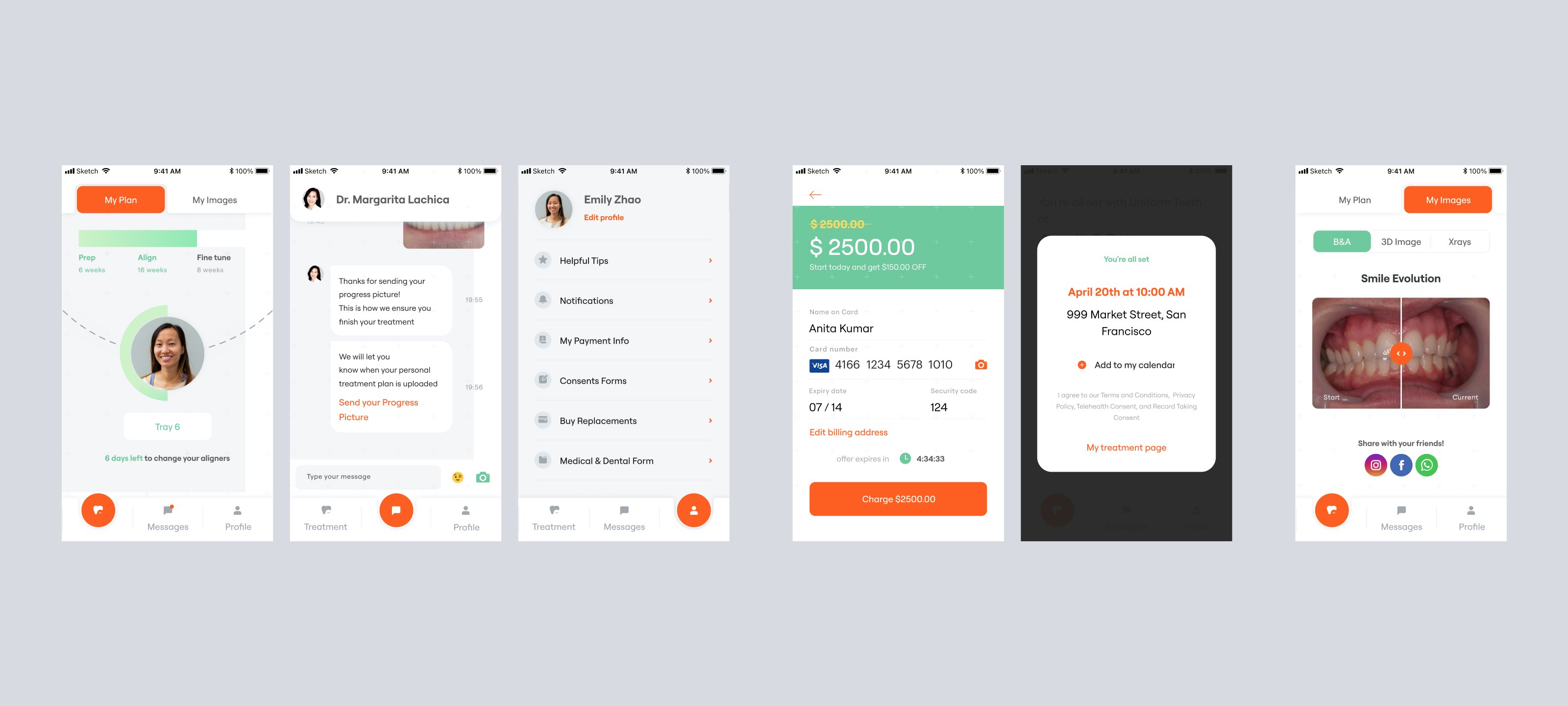 The old app: tab bar changing across Home, Messages and Profile; payment with a countdown and card data in plain text; consent in fine print; before/after hidden under My Images